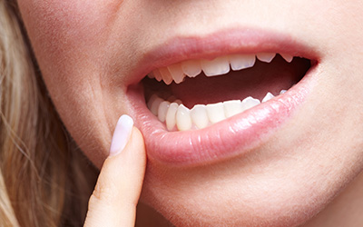 Woman showing teeth