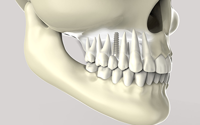 3D model of teeth