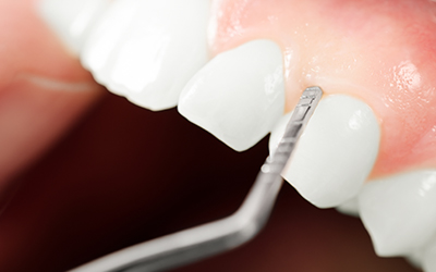 gums examination up-close