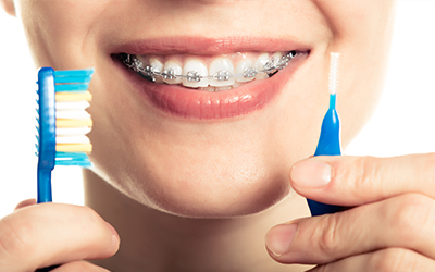 woman smiling with braces on and a toothbrush and a cleaning brush for braces in her hand
